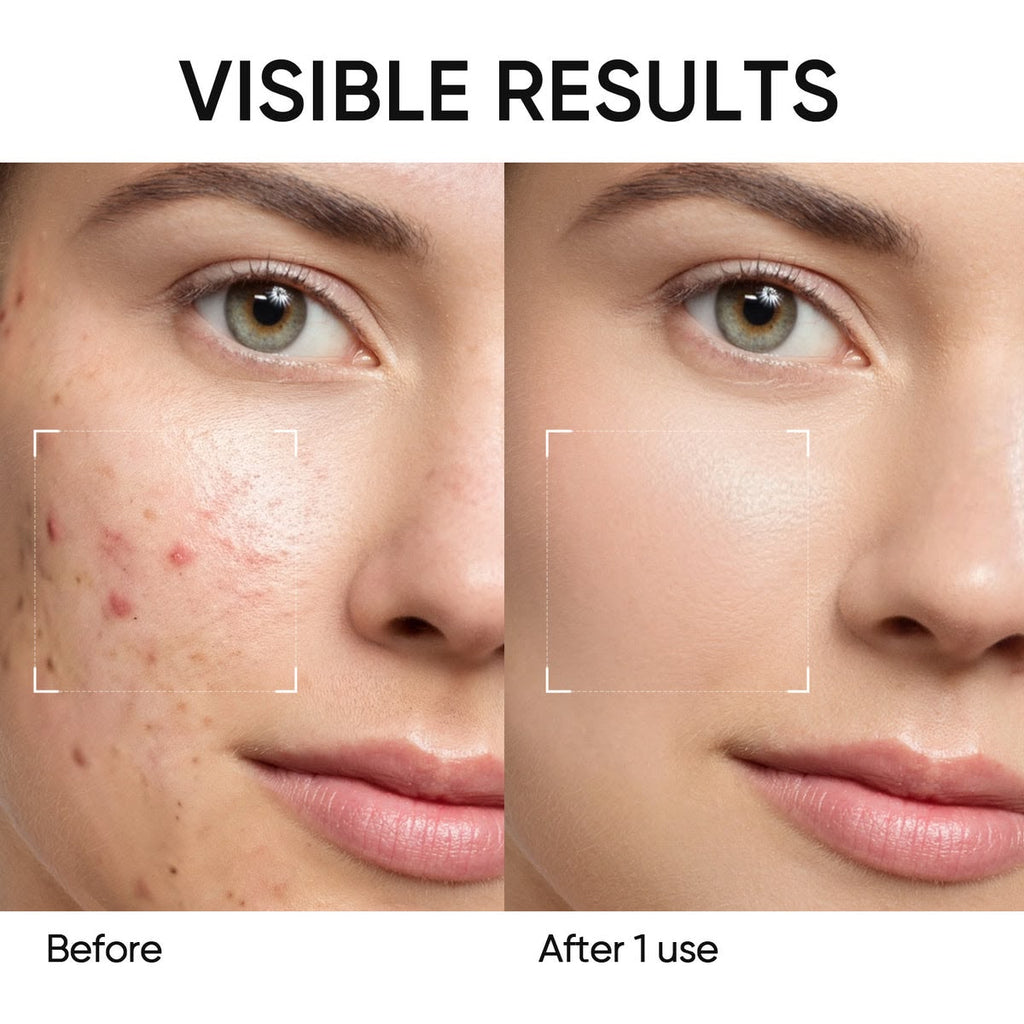 Mugwort Anti Pores & Acne Clay Mask Stick
